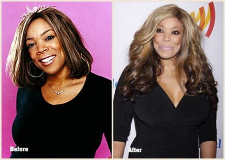 Wendy Williams' Plastic Surgery Journey: Uncovering Surprising Truths